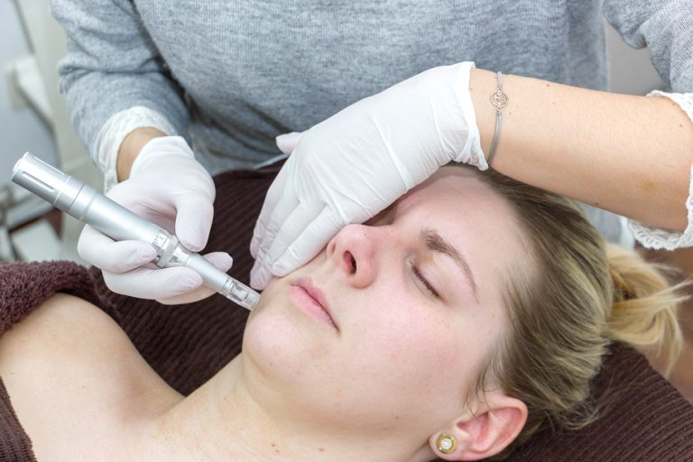 Needling Kosmetik Needling Gesichtsbehandlung