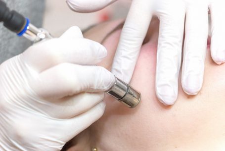 Mikrodermabrasion